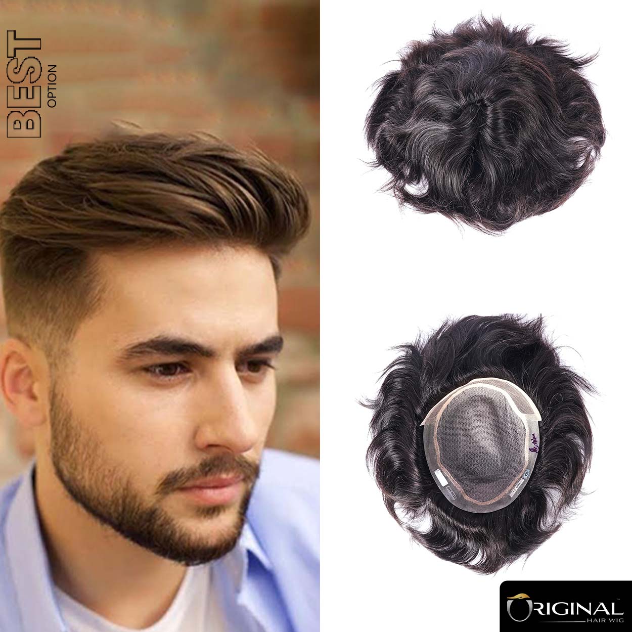 Golden Mirage Front Lace Patch